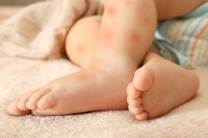 Read more about the article Alergia alimentar e nutrição materno-infantil: entenda a relação