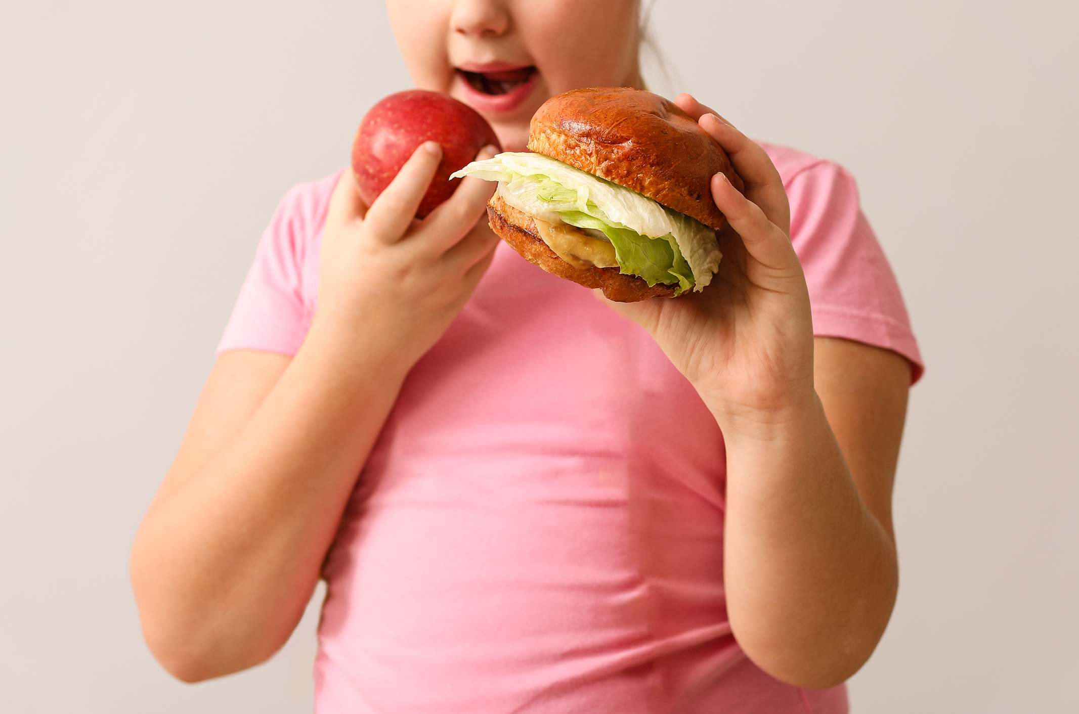 You are currently viewing Obesidade infantil: apenas atividade física resolve?